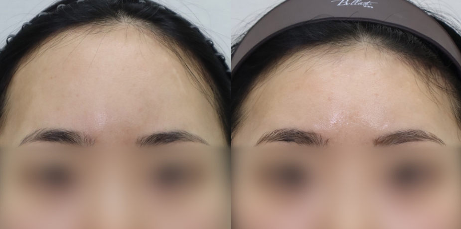 Newline Clinic — recent post 5